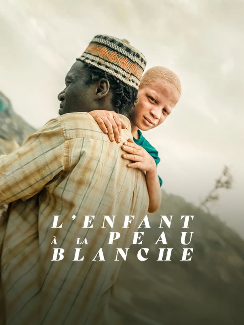 The Boy with White Skin