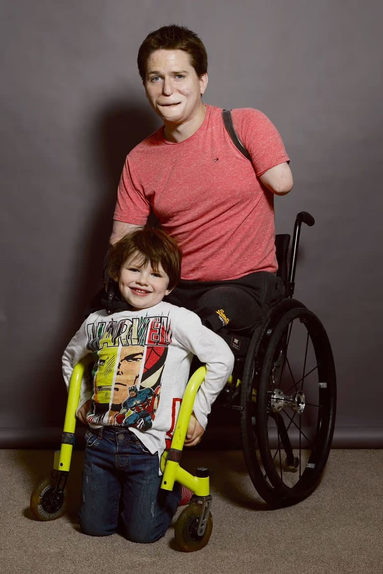 The Extraordinary Case of Alex Lewis