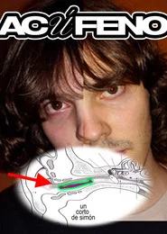 Acúfeno