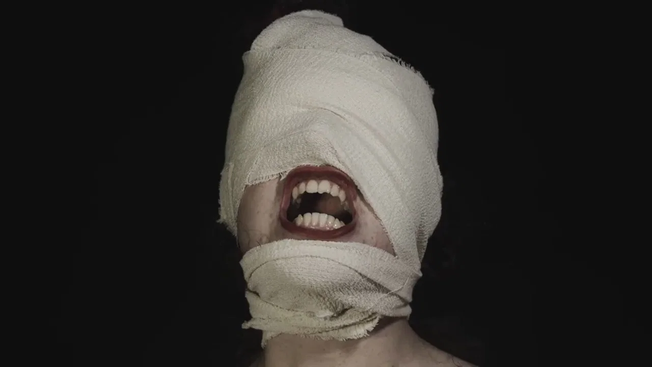 The Bite