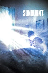 Sunburnt